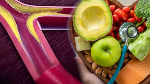 Reduce el colesterol de forma natural