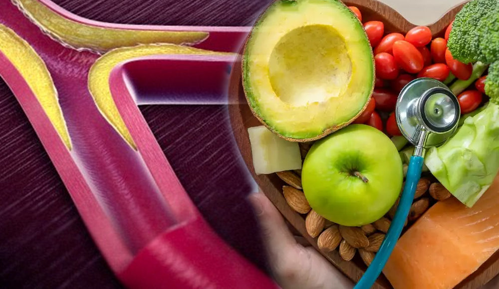Reduce el colesterol de forma natural