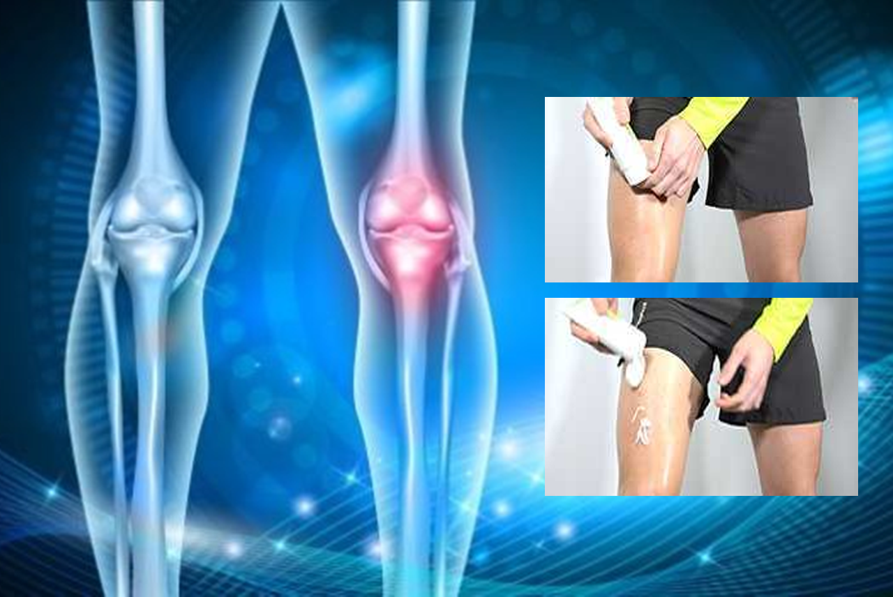 ¿Solución ideal para el dolor?: el gel frío para articulaciones
